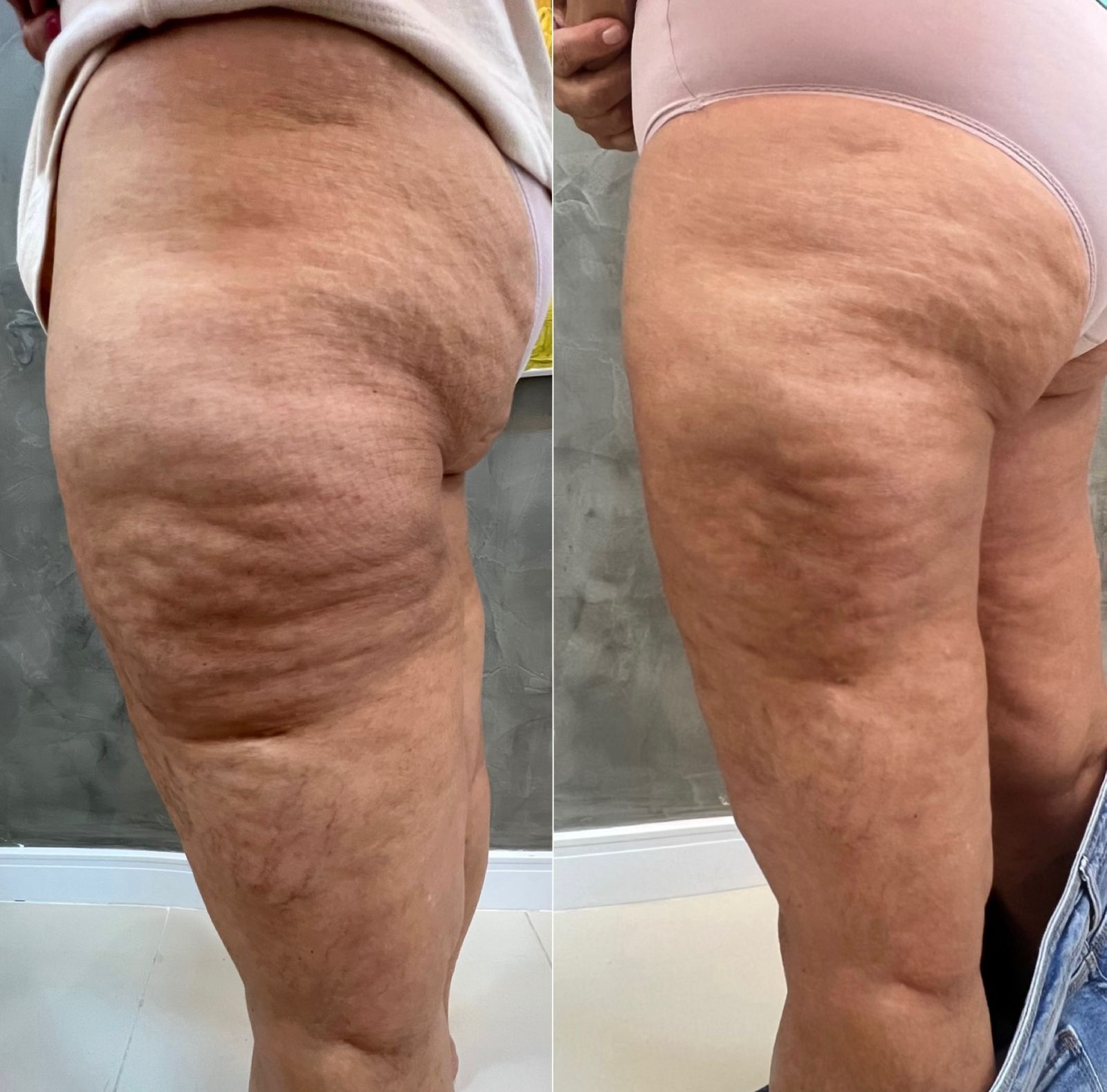 WhatsApp Image 2024-11-19 at 11.17.21